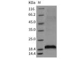 Recombinant Mouse MANF/ARMET Protein (His Tag)