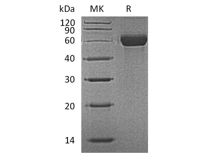 Recombinant Mouse MARCO Protein (His Tag)