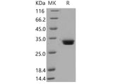 Recombinant Mouse MCPT1 Protein (His Tag)