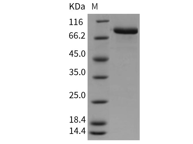 Recombinant Mouse MFI2/CD228 Protein (His Tag)