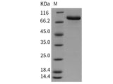 Recombinant Mouse MFI2/CD228 Protein (His Tag)