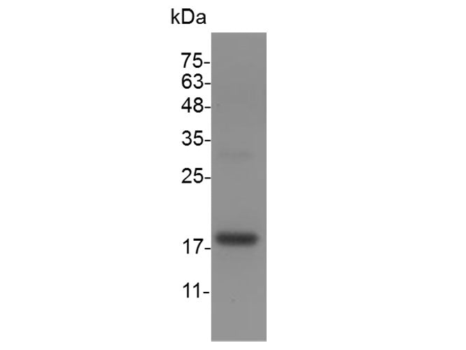 Recombinant Mouse Midkine protein(N-His)