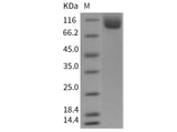 Recombinant Mouse NAALADL1 Protein (His Tag)