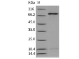 Recombinant Mouse NEK3 Protein (His & GST Tag)(Active)