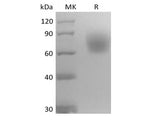 Recombinant Mouse Neurotrophic Tyrosine Kinase Receptor Type 2/TrkB/NTRK2 (C-6His)