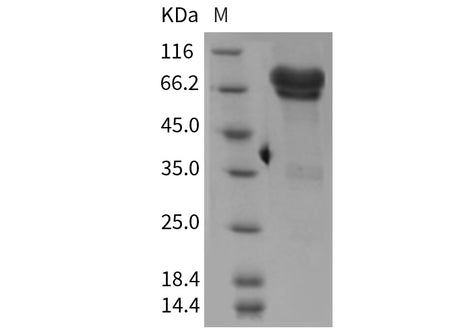Recombinant Mouse NGFR/CD271 Protein (Fc Tag)(Active)