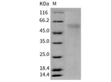 Recombinant Mouse NGFR/CD271 Protein (His Tag)