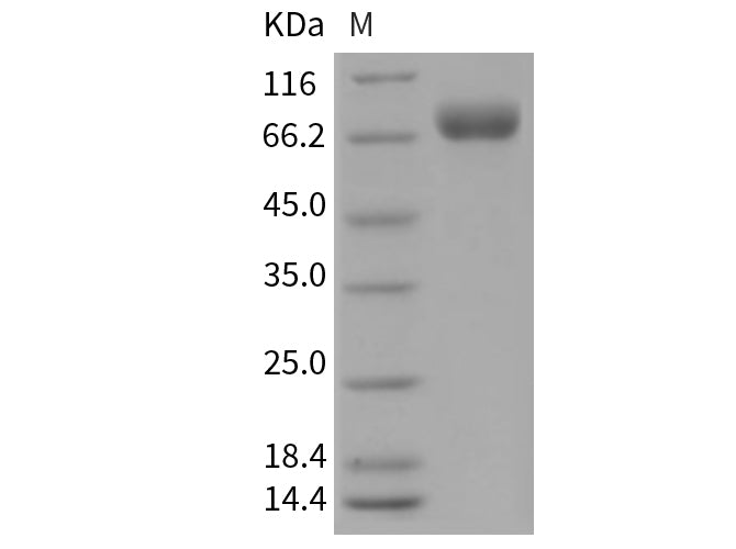 Recombinant Mouse OBCAM/OPCML Protein (aa 1-541, His Tag)(Active)