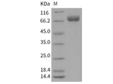 Recombinant Mouse OBCAM/OPCML Protein (aa 1-541, His Tag)(Active)