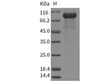 Recombinant Mouse Osteoprotegerin/TNFRSF11B Protein (Fc Tag)