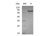 Recombinant Mouse OX40/TNFRSF4 Protein (Fc Tag)(Active)