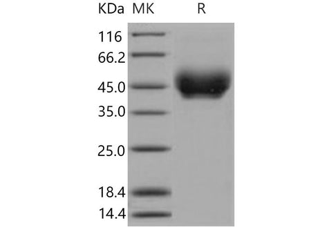 Recombinant Mouse PD-L1/B7-H1/CD274 Protein (His Tag) (Active)