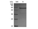 Recombinant Mouse Pentraxin-related protein PTX3(N-6His)