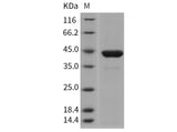 Recombinant Mouse PGK1/PGKA Protein (His Tag)(Active)