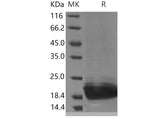 Recombinant Mouse PGLYRP1/PGRP-S Protein (His Tag)
