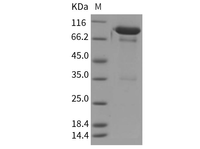 Recombinant Mouse PGRL/IGSF8 Protein (Fc Tag)