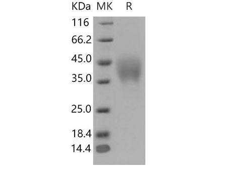 Recombinant Mouse PILR-alpha/PILRA Protein (His Tag)(Active)