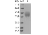 Recombinant Mouse PILR-alpha/PILRA Protein (His Tag)(Active)