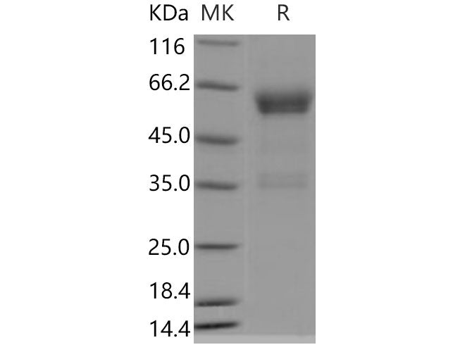 Recombinant Mouse PILRB1 Protein (Fc Tag)