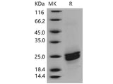 Recombinant Mouse PLA2G12B/PLA2G13 Protein (His Tag)