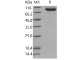 Recombinant Mouse PLAUR/uPAR Protein (His & Fc Tag)(Active)