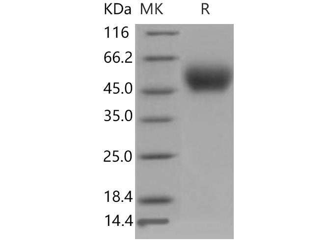 Recombinant Mouse PLAUR/uPAR Protein (His Tag)(Active)