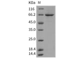 Recombinant Mouse PLK1/PLK-1 Protein (His Tag)(Active)