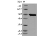 Recombinant Mouse PPM1A Protein (His Tag)