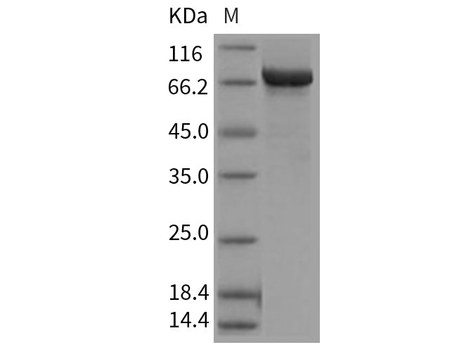 Recombinant Mouse Prolyl endopeptidase/PREP Protein (His Tag)