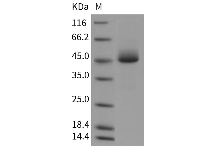 Recombinant Mouse Prostatic Acid Phosphatase/ACPP Protein (His Tag)