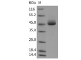 Recombinant Mouse Prostatic Acid Phosphatase/ACPP Protein (His Tag)