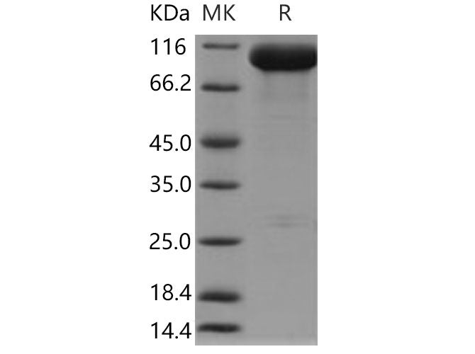 Recombinant Mouse PSMA/FOLH1 Protein (His Tag)