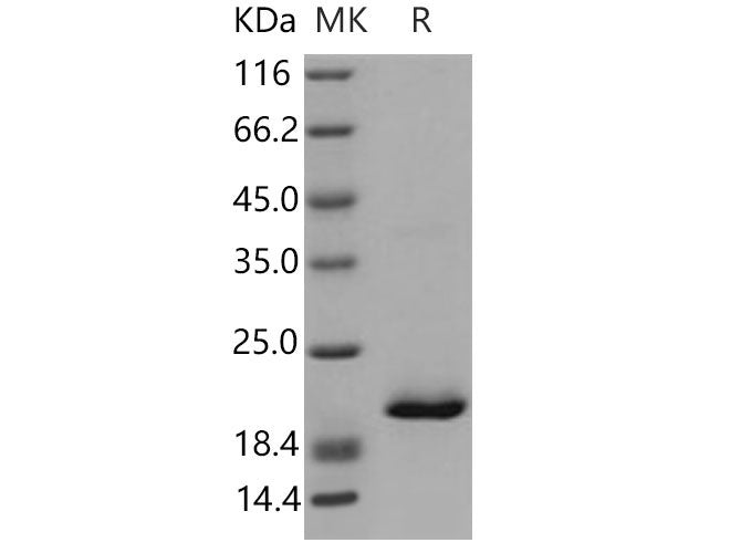 Recombinant Mouse RBP4 Protein (His Tag)(Active)