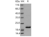 Recombinant Mouse RBP4 Protein (His Tag)(Active)