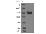 Recombinant Mouse REG2/REG-2 Protein (Fc Tag)