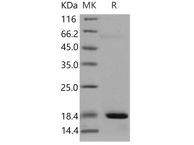 Recombinant Mouse REG3A/HIP Protein (His Tag)
