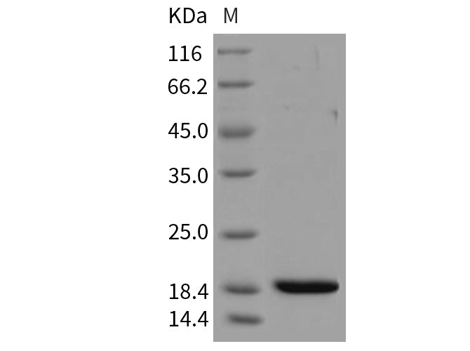 Recombinant Mouse REG3B/Pap1 Protein (His Tag)