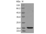 Recombinant Mouse REG3B/Pap1 Protein (His Tag)