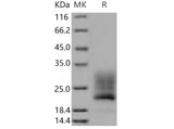 Recombinant Mouse REG4/RELP Protein (His Tag)(Active)