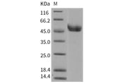 Recombinant Mouse REN1/Renin-1 Protein (His Tag)(Active)