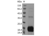 Recombinant Mouse S100A9 Protein (His Tag)