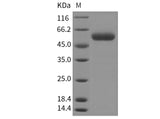 Recombinant Mouse SCPEP1/RISC Protein (His Tag)