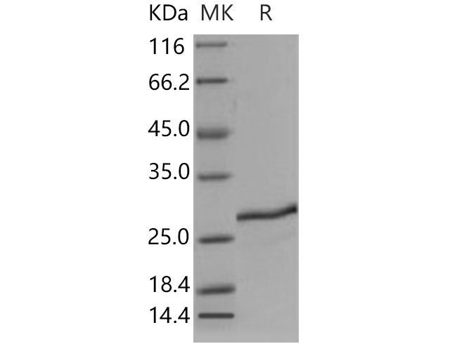 Recombinant Mouse SDF2 Protein (His Tag)