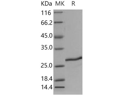 Recombinant Mouse SDF2 Protein (His Tag)