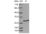 Recombinant Mouse SDF2 Protein (His Tag)