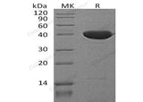 Recombinant Mouse Serpin F1/PEDF Protein (His Tag)(Active)