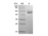 Recombinant Mouse SerpinA1/A1AT Protein (His Tag)