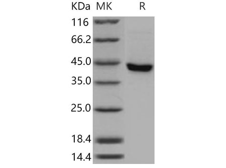 Recombinant Mouse SerpinB8 Protein (His Tag)