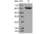 Recombinant Mouse SerpinD1/HCF2 Protein (His Tag)(Active)