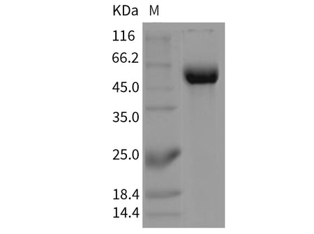 Recombinant Mouse Siglec-2/CD22 Protein (Fc Tag)